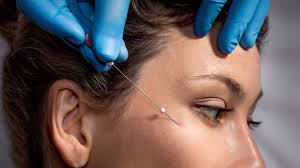 Cosmetic Threads Market Growth, Share, Opportunities & Competitive Analysis, 2024 – 2032