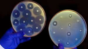 Antimicrobial Susceptibility Test Market Growth, Share, Opportunities & Competitive Analysis, 2024 – 2032