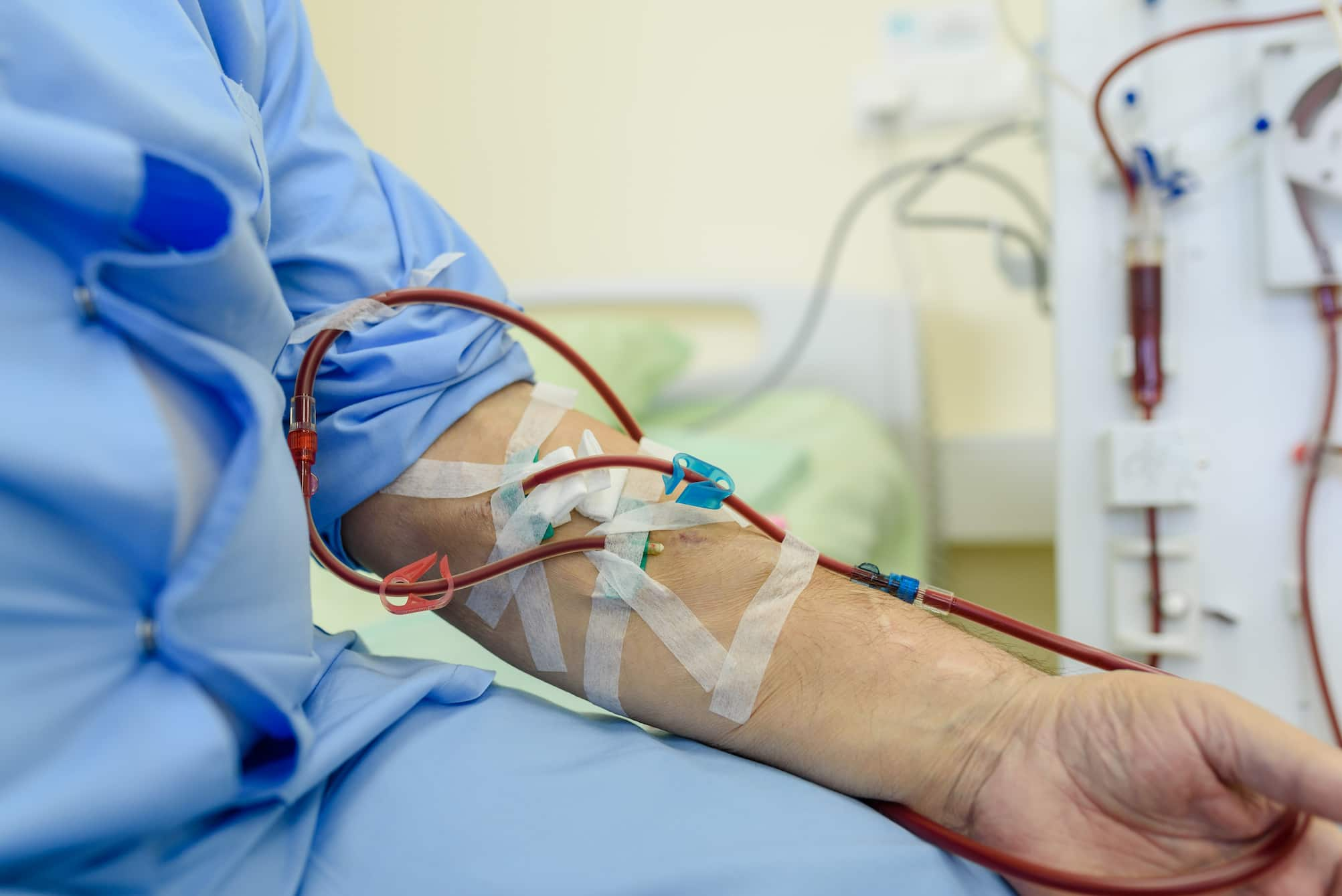 Hemodialysis and Peritoneal Dialysis Market Growth, Share, Opportunities & Competitive Analysis, 2024 – 2032