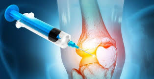 Orthobiologics Market Growth, Share, Opportunities & Competitive Analysis, 2024 – 2032