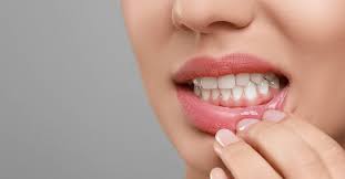 Periodontal Disease Market Growth, Share, Opportunities & Competitive Analysis, 2024 – 2032